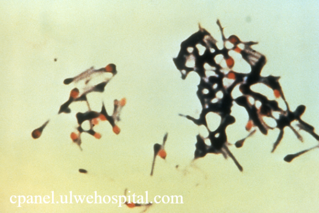 Clostridium Tetani Bakteri Penyebab Tetanus